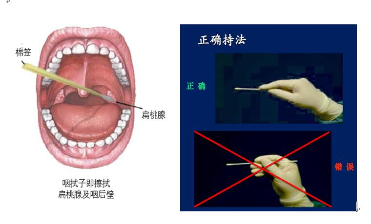 新冠核酸检测