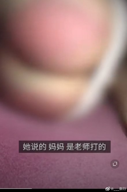 班主任承认打人,称孩子不使劲哭又不躲,以为打得不疼?