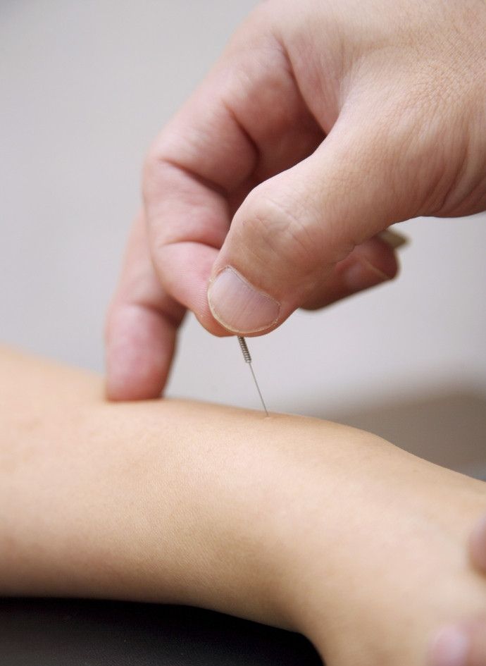 针灸/推拿#今年毕业应届生,河南中医药大学,针灸推拿学专业,在西安有