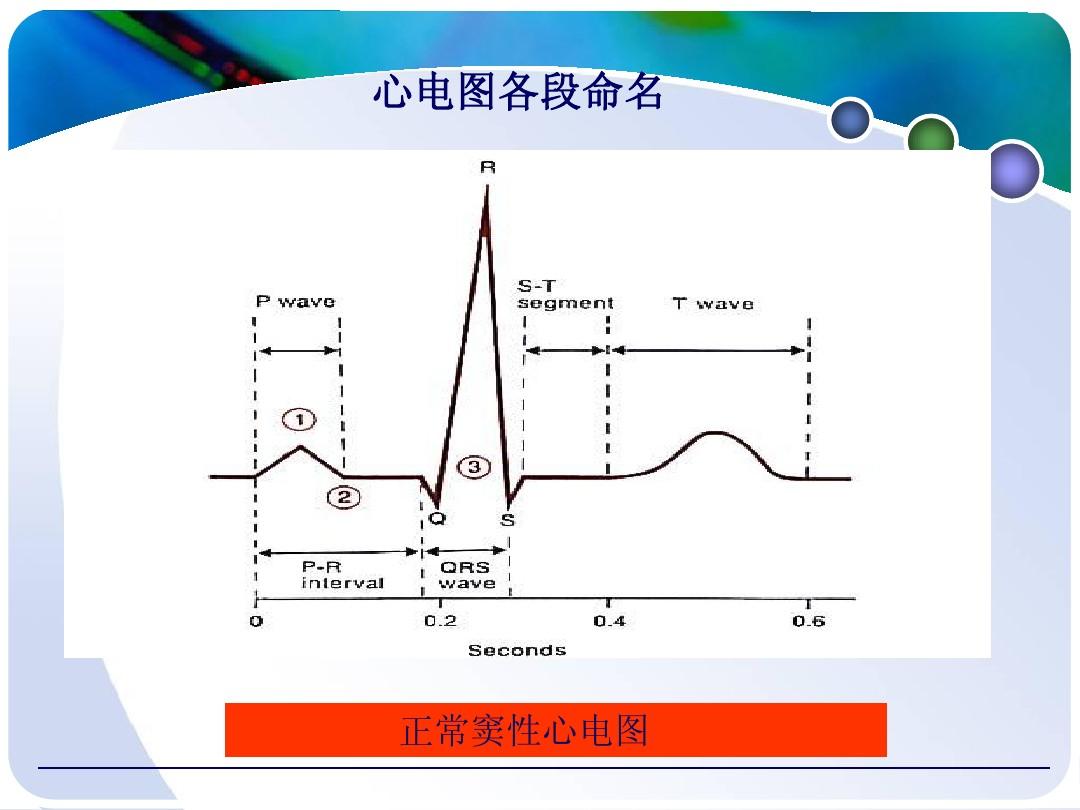 心电图q波正常值图片